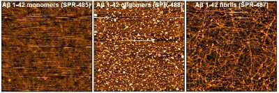 Immunomicroscopy: beta Amyloid 42 Peptide [NBP3-18318]